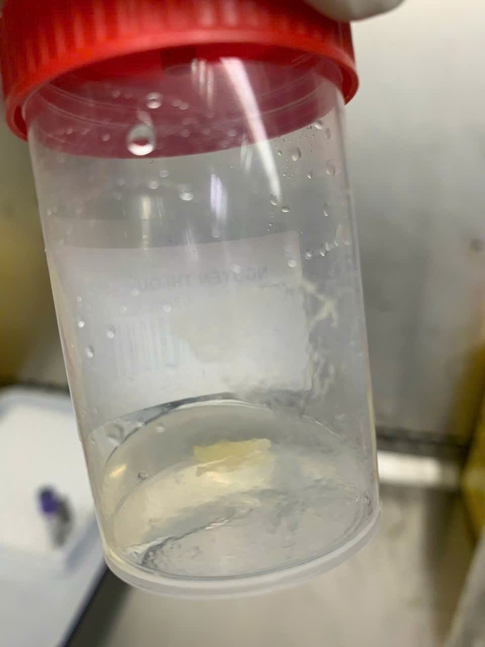 Hình ảnh tin tức PHÁT HIỆN TRƯỜNG HỢP NHIỄM SÁN DÂY – CẢNH BÁO NGUY CƠ NHIỄM KÝ SINH TRÙNG TỪ THỰC PHẨM CHƯA NẤU CHÍN